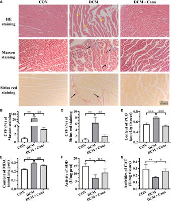 Canagliflozin mitigates ferroptosis and improves myocardial oxidative stress in mice with diabetic cardiomyopathy